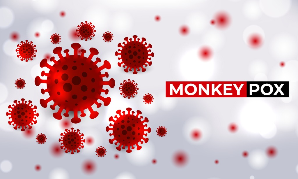 What Employers Need to Know About Monkeypox